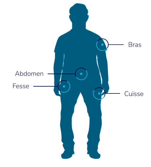 Les mots bras, cuisse, abdomen et fesse autour d’une silhouette